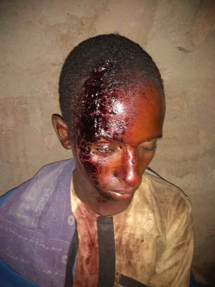 Togolese farmer attacks 16-year-old cattle herder in Kwara