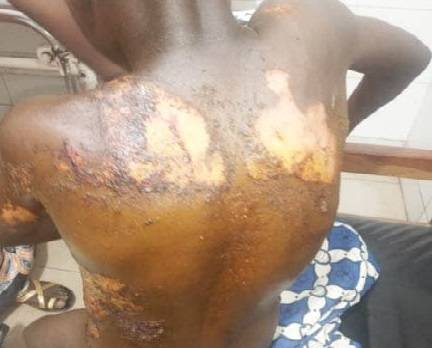 Mother baths 8-yr-old son with hot water for stealing Nut in Kaduna The Informant247