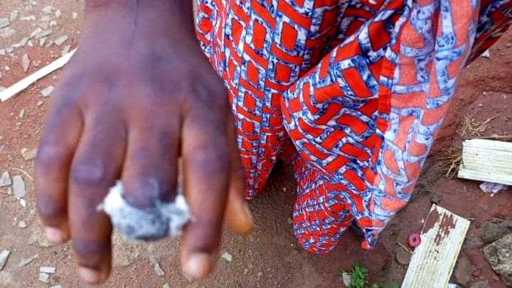 Woman cuts off 10-year-old girl’s finger over missing N50 that was later found The Informant247