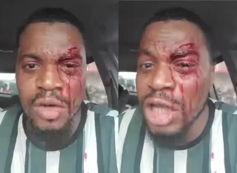 Hoodlums attack nollywood actor 768x559.jpg