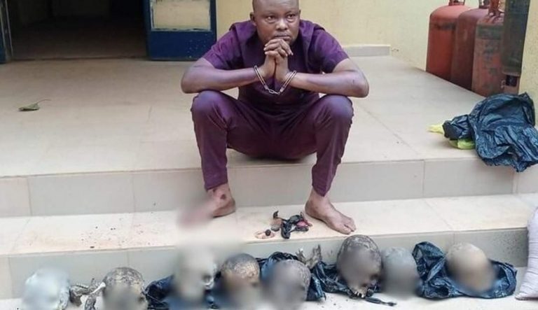 Man caught with human skulls (1)