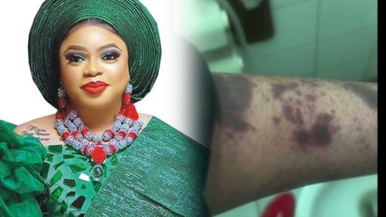 “I’m badly injured” – Bobrisky re-arrested by EFCC at Lagos airport